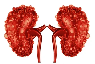 Kidney